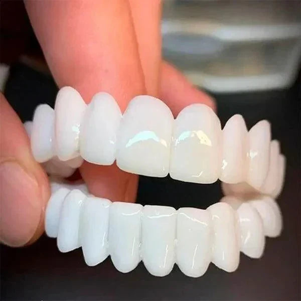 SmilePro — Carillas dentales ajustables de resina